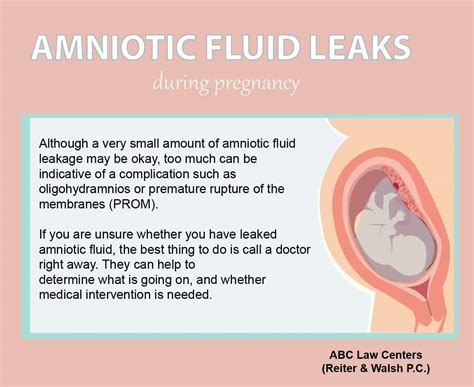 how to know if amniotic fluid is leaking|Leaking Amniotic Fluid: How to Tell